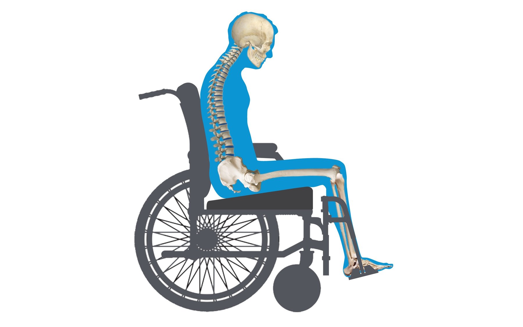 Wheelchair Seating & Positioning Guide